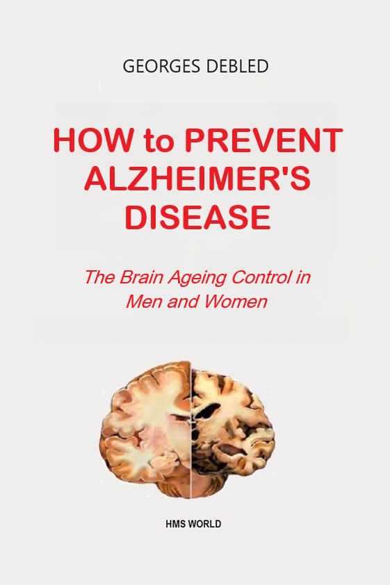 ALZHEIMER PREVENT